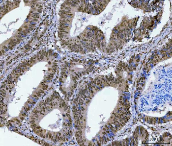 SA2/STAG2 Antibody