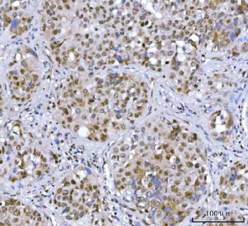 SA2/STAG2 Antibody