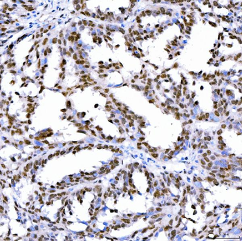 SA2/STAG2 Antibody