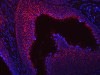 SUMF2 Antibody