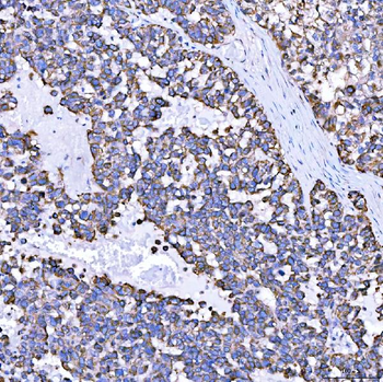 SUMF2 Antibody