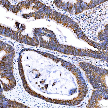 SUMF2 Antibody
