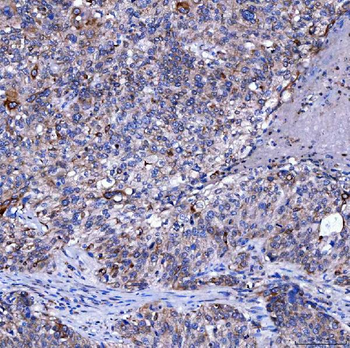 SUMF2 Antibody