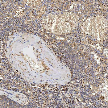 SUCLG2 Antibody