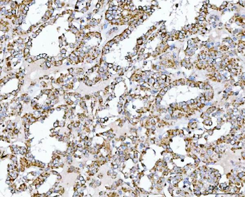 SUCLG2 Antibody