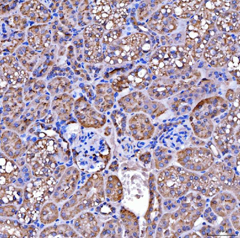 SUCLG2 Antibody
