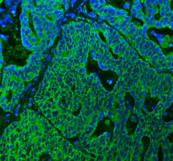 SUCLG2 Antibody