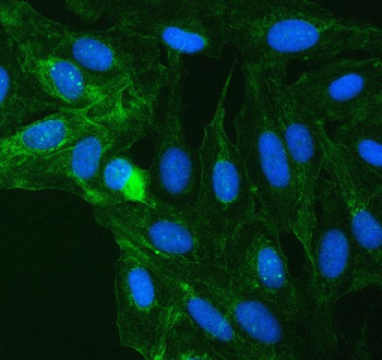 SUCLG2 Antibody