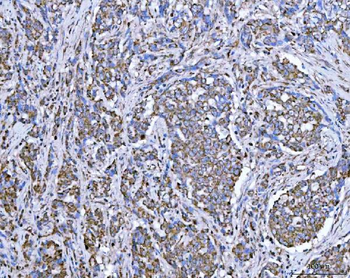 SUCLG2 Antibody