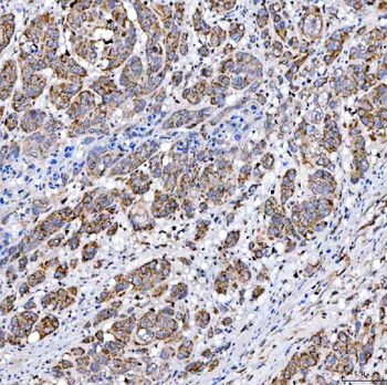 SUCLG2 Antibody
