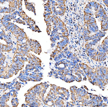 SUCLG2 Antibody