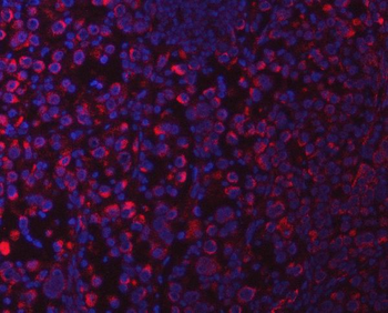 SUCLG1 Antibody