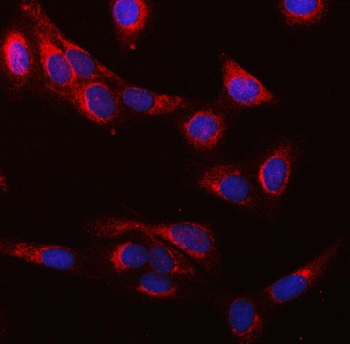 SUCLG1 Antibody