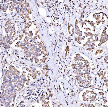 SUCLG1 Antibody