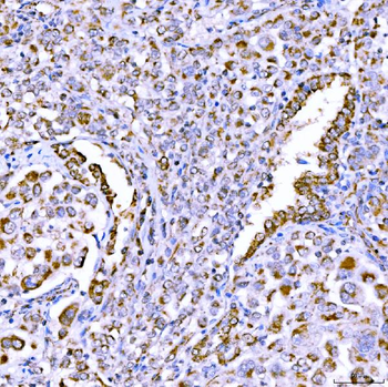 SUCLG1 Antibody