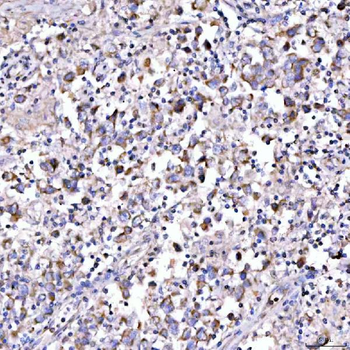 SUCLG1 Antibody