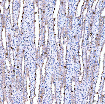 SUCLG1 Antibody