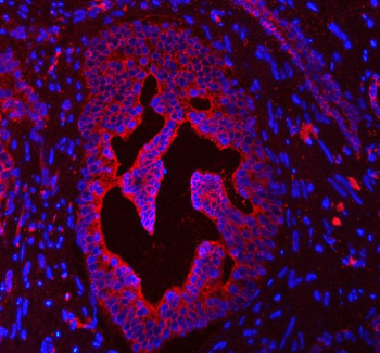 Cytokeratin 4/KRT4 Antibody