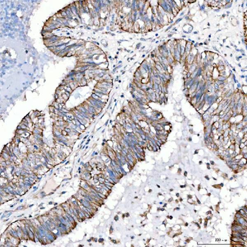 Cytokeratin 4/KRT4 Antibody