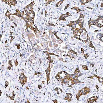 Cytokeratin 4/KRT4 Antibody
