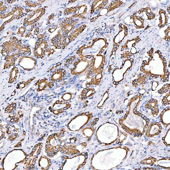 Cytokeratin 4/KRT4 Antibody