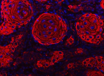 Cytokeratin 2e/KRT2 Rabbit Polyclonal Antibody