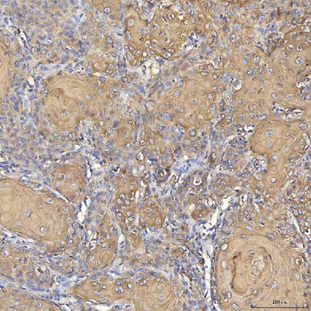Cytokeratin 2e/KRT2 Rabbit Polyclonal Antibody