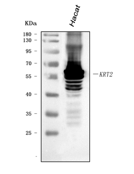 Cytokeratin 2e/KRT2 Rabbit Polyclonal Antibody