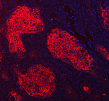 Cytokeratin 1/KRT1 Rabbit Polyclonal Antibody