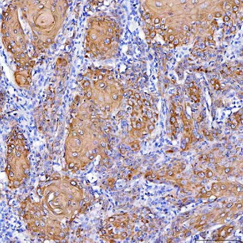Cytokeratin 1/KRT1 Rabbit Polyclonal Antibody