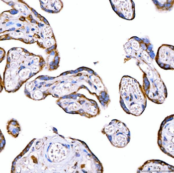 RAB7/RAB7A Antibody
