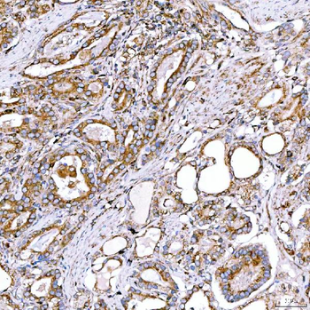 RAB7/RAB7A Antibody