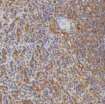 RAB7/RAB7A Antibody