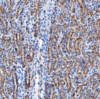 RAB7/RAB7A Antibody