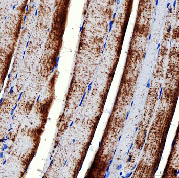 RAB7/RAB7A Antibody