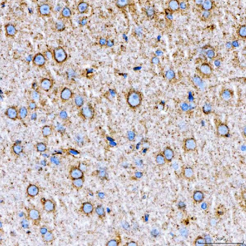 RAB7/RAB7A Antibody