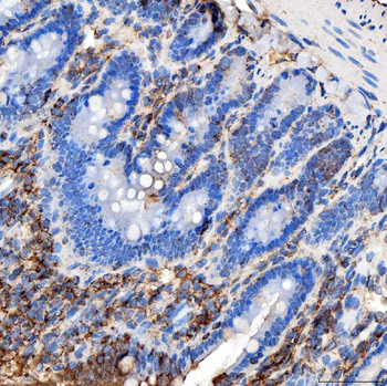 RAB7/RAB7A Antibody