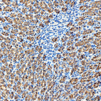 RAB7/RAB7A Antibody
