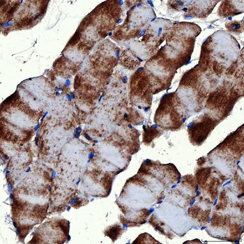 RAB7/RAB7A Antibody