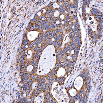 RAB7/RAB7A Antibody