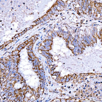 RAB7/RAB7A Antibody