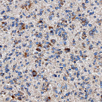 RAB7/RAB7A Antibody