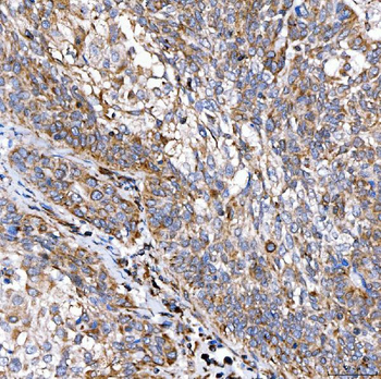 RAB7/RAB7A Antibody