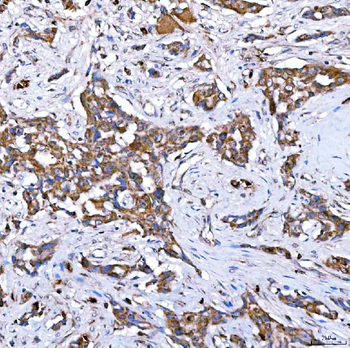 RAB7/RAB7A Antibody