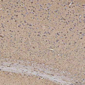 Synaptogyrin 3/SYNGR3 Rabbit Polyclonal Antibody