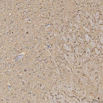 Synaptogyrin 3/SYNGR3 Rabbit Polyclonal Antibody