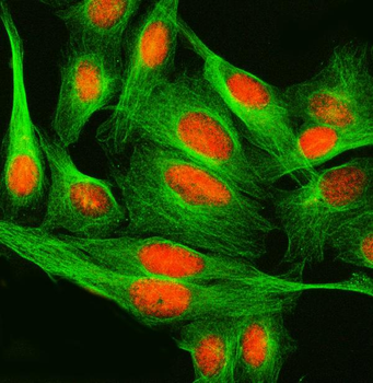 SPRED2 Rabbit Polyclonal Antibody