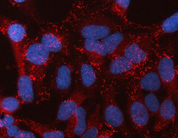 STON2 Rabbit Polyclonal Antibody