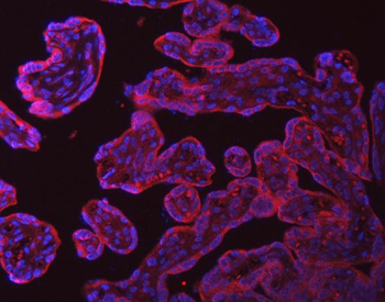SRPRA Rabbit Polyclonal Antibody