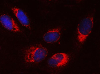 SRPRA Rabbit Polyclonal Antibody